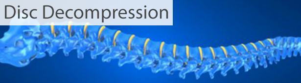 banner-discdecomp